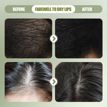 ⏳Zeitlich begrenztes Sonderangebot⏰ Hochwirksames Festshampoo mit natürlichen Inhaltsstoffen🧼